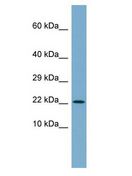 C4orf3 Antibody - C4orf3 antibody Western Blot of COLO205. Antibody dilution: 1 ug/ml.  This image was taken for the unconjugated form of this product. Other forms have not been tested.