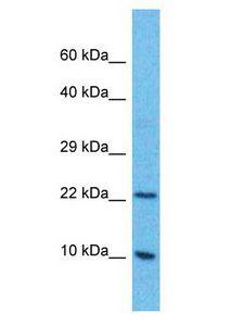 C4orf3 Antibody - C4orf3 antibody Western Blot of Thymus Tumor. Antibody dilution: 1 ug/ml.  This image was taken for the unconjugated form of this product. Other forms have not been tested.