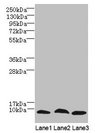 C4orf3 Antibody - Western Blot All lanes: C4orf3 antibody at 6µg/ml Lane 1: 293T whole cell lysate Lane 2: Hela whole cell lysate Lane 3: HepG2 whole cell lysate Secondary Goat polyclonal to rabbit IgG at 1/10000 dilution Predicted band size: 8, 23 kDa Observed band size: 8 kDa