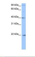 C4orf33 Antibody - Jurkat cell lysate. Antibody concentration: 0.5 ug/ml. Gel concentration: 12%.  This image was taken for the unconjugated form of this product. Other forms have not been tested.