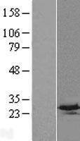 C4orf33 Protein - Western validation with an anti-DDK antibody * L: Control HEK293 lysate R: Over-expression lysate