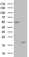 C4orf36 Antibody - HEK293T cells were transfected with the pCMV6-ENTRY control. (Left lane) or pCMV6-ENTRY C4orf36. (Right lane) cDNA for 48 hrs and lysed. Equivalent amounts of cell lysates. (5 ug per lane) were separated by SDS-PAGE and immunoblotted with anti-C4orf36. (1:500)