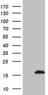 C4orf36 Antibody - HEK293T cells were transfected with the pCMV6-ENTRY control. (Left lane) or pCMV6-ENTRY C4orf36. (Right lane) cDNA for 48 hrs and lysed. Equivalent amounts of cell lysates. (5 ug per lane) were separated by SDS-PAGE and immunoblotted with anti-C4orf36. (1:2000)