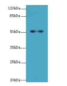 C4orf37 Antibody - Western blot. All lanes: STPG2 antibody at 0.8 ug/ml+HL4- whole cell lysate Goat polyclonal to rabbit at 1:10000 dilution. Predicted band size: 51 kDa. Observed band size: 51 kDa.