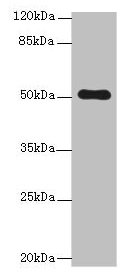 C4orf37 Antibody - Western blot All lanes: STPG2 antibody at 0.8µg/ml + HL60 whole cell lysate Secondary Goat polyclonal to rabbit IgG at 1/10000 dilution Predicted band size: 51 kDa Observed band size: 51 kDa