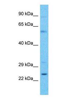 C4orf45 Antibody - Western blot of C4orf45 Antibody with human HeLa Whole Cell lysate.  This image was taken for the unconjugated form of this product. Other forms have not been tested.