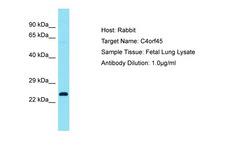 C4orf45 Antibody -  This image was taken for the unconjugated form of this product. Other forms have not been tested.