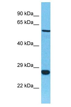 C4orf49 / OSAP Antibody - C4orf49 / OSAP antibody Western Blot of Uterus Tumor. Antibody dilution: 1 ug/ml.  This image was taken for the unconjugated form of this product. Other forms have not been tested.