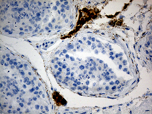 C4orf49 / OSAP Antibody - Immunohistochemical staining of paraffin-embedded Human testicle tissue within the normal limits using anti-MGARP mouse monoclonal antibody. (Heat-induced epitope retrieval by 1mM EDTA in 10mM Tris buffer. (pH8.5) at 120°C for 3 min. (1:500)