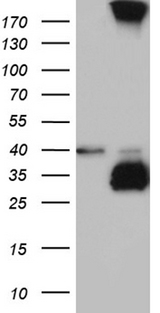 C4orf49 / OSAP Antibody - HEK293T cells were transfected with the pCMV6-ENTRY control. (Left lane) or pCMV6-ENTRY MGARP. (Right lane) cDNA for 48 hrs and lysed. Equivalent amounts of cell lysates. (5 ug per lane) were separated by SDS-PAGE and immunoblotted with anti-MGARP. (1:2000)