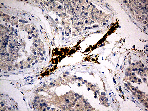 C4orf49 / OSAP Antibody - Immunohistochemical staining of paraffin-embedded Human testicle tissue within the normal limits using anti-MGARP mouse monoclonal antibody. (Heat-induced epitope retrieval by 1mM EDTA in 10mM Tris buffer. (pH8.5) at 120°C for 3 min. (1:500)