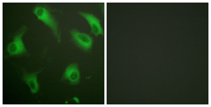 C5AR1 / CD88 / C5a Receptor Antibody - Immunofluorescence analysis of HeLa cells, using CD88/C5aR Antibody. The picture on the right is blocked with the synthesized peptide.