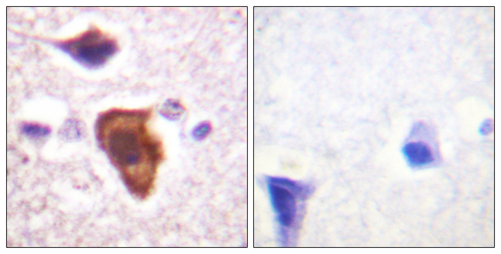 C5AR1 / CD88 / C5a Receptor Antibody - Immunohistochemistry analysis of paraffin-embedded human brain tissue, using CD88/C5aR Antibody. The picture on the right is blocked with the synthesized peptide.