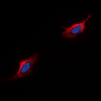 C5AR1 / CD88 / C5a Receptor Antibody - Immunofluorescent analysis of CD88 staining in HepG2 cells. Formalin-fixed cells were permeabilized with 0.1% Triton X-100 in TBS for 5-10 minutes and blocked with 3% BSA-PBS for 30 minutes at room temperature. Cells were probed with the primary antibody in 3% BSA-PBS and incubated overnight at 4 ??C in a humidified chamber. Cells were washed with PBST and incubated with a DyLight 594-conjugated secondary antibody (red) in PBS at room temperature in the dark. DAPI was used to stain the cell nuclei (blue).