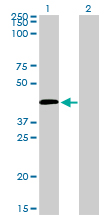 C5AR1 / CD88 / C5a Receptor Antibody - Western Blot analysis of C5R1 expression in transfected 293T cell line by C5R1 monoclonal antibody (M02), clone 4E2.Lane 1: C5R1 transfected lysate(39.3 KDa).Lane 2: Non-transfected lysate.