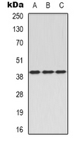 C5AR1 / CD88 / C5a Receptor Antibody - Western blot analysis of CD88 expression in A549 (A); mouse brain (B); rat spleen (C) whole cell lysates.