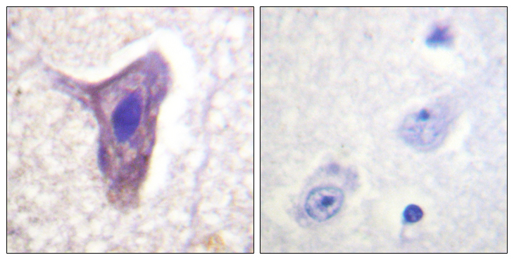 C5AR1 / CD88 / C5a Receptor Antibody - Immunohistochemistry analysis of paraffin-embedded human brain, using CD88/C5aR (Phospho-Ser338) Antibody. The picture on the right is blocked with the phospho peptide.