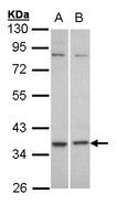 C5AR2 / GPR77 / C5L2 Antibody - Sample (30 ug of whole cell lysate). A: HeLa, B: Molt-4 . 10% SDS PAGE. C5L2 antibody diluted at 1:1000