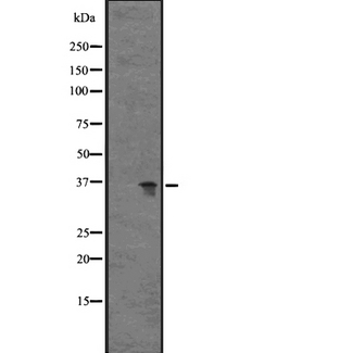 C5AR2 / GPR77 / C5L2 Antibody - Western blot analysis of GPR77 expression in HeLa cells lysate. The lane on the left is treated with the antigen-specific peptide.