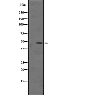 C5AR2 / GPR77 / C5L2 Antibody - Western blot analysis of C5ARL expression in HeLa cells lysate. The lane on the left is treated with the antigen-specific peptide.