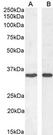 C5AR2 / GPR77 / C5L2 Antibody - Anti-Human C5aR2 (GPR77) (0.03µg/ml) staining of A541 (A) and HeLa (B) lysates (35µg protein in RIPA buffer). Primary incubation was 1 hour. Detected by chemiluminescence.