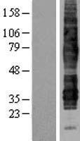 C5AR2 / GPR77 / C5L2 Protein - Western validation with an anti-DDK antibody * L: Control HEK293 lysate R: Over-expression lysate