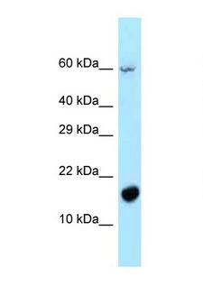 C5orf13 Antibody - C5orf13 antibody Western blot of 721_B Cell lysate. Antibody concentration 1 ug/ml.  This image was taken for the unconjugated form of this product. Other forms have not been tested.