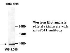 C5orf13 Antibody