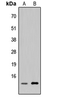 C5orf13 Antibody - Western blot analysis of p311 expression in HEK293T (A); H9C2 (B) whole cell lysates.