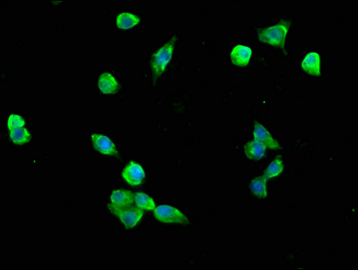 C5orf13 Antibody - Immunofluorescence staining of SH-SY5Y cells at a dilution of 1:200, counter-stained with DAPI. The cells were fixed in 4% formaldehyde, permeabilized using 0.2% Triton X-100 and blocked in 10% normal Goat Serum. The cells were then incubated with the antibody overnight at 4 °C.The secondary antibody was Alexa Fluor 488-congugated AffiniPure Goat Anti-Rabbit IgG (H+L) .
