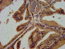 C5orf13 Antibody - Immunohistochemistry image at a dilution of 1:600 and staining in paraffin-embedded human prostate tissue performed on a Leica BondTM system.