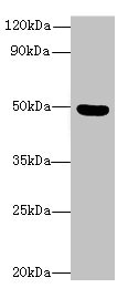 C5orf22 Antibody - Western blot All lanes: C5orf22 antibody at 8µg/ml + Mouse brain tissue Secondary Goat polyclonal to rabbit IgG at 1/10000 dilution Predicted band size: 50, 21, 19 kDa Observed band size: 50 kDa