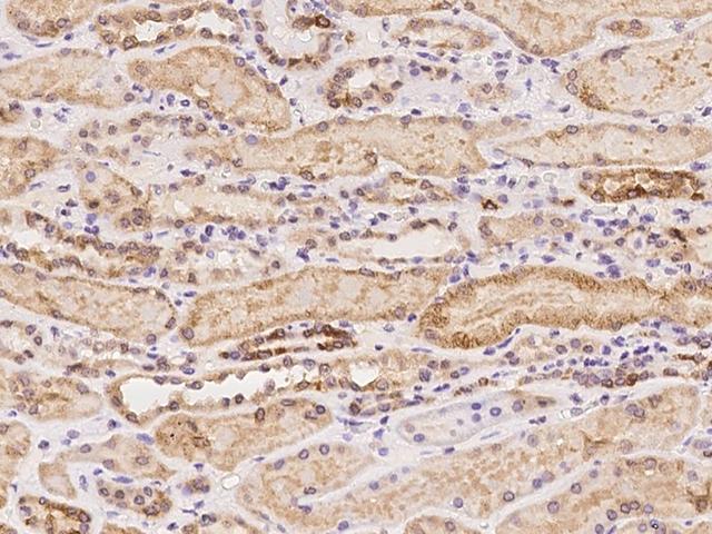 C5orf22 Antibody - Immunochemical staining of human C5orf22 in human skeletal muscle with rabbit polyclonal antibody at 1:100