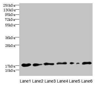 C5orf24 Antibody - Western blot All lanes: C5orf24 antibody at 0.3µg/ml Lane 1: Mouse gonadal tissue Lane 2: K562 whole cell lysate Lane 3: THP-1 whole cell lysate Lane 4: U87 whole cell lysate Lane 5: HepG2 whole cell lysate Lane 6: Hela whole cell lysate Secondary Goat polyclonal to rabbit IgG at 1/10000 dilution Predicted band size: 21, 17 kDa Observed band size: 21 kDa