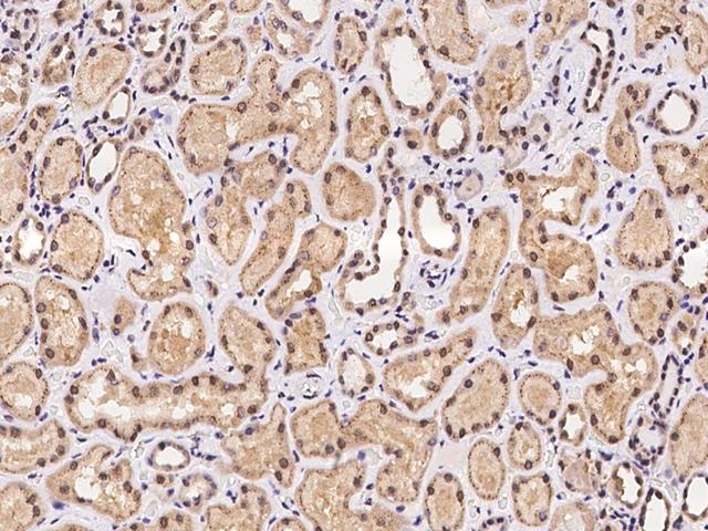 C5orf24 Antibody - Immunochemical staining of human C5orf24 in human kidney with rabbit polyclonal antibody at 1:100 dilution, formalin-fixed paraffin embedded sections.
