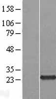 C5orf24 Protein - Western validation with an anti-DDK antibody * L: Control HEK293 lysate R: Over-expression lysate