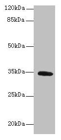C5orf35 Antibody - Western blot All lanes: SETD9 antibody at 6µg/ml + K562 whole cell lysate Secondary Goat polyclonal to rabbit IgG at 1/10000 dilution Predicted band size: 35, 31 kDa Observed band size: 35 kDa