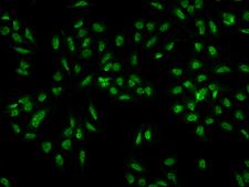 C5orf41 Antibody - Immunofluorescence staining of CREBRF in U2OS cells. Cells were fixed with 4% PFA, permeabilzed with 0.3% Triton X-100 in PBS, blocked with 10% serum, and incubated with rabbit anti-Human CREBRF polyclonal antibody (dilution ratio 1:100) at 4°C overnight. Then cells were stained with the Alexa Fluor 488-conjugated Goat Anti-rabbit IgG secondary antibody (green). Positive staining was localized to Nucleus.