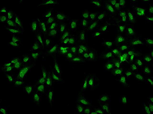 C5orf41 Antibody - Immunofluorescence staining of CREBRF in U2OS cells. Cells were fixed with 4% PFA, permeabilzed with 0.3% Triton X-100 in PBS, blocked with 10% serum, and incubated with rabbit anti-Human CREBRF polyclonal antibody (dilution ratio 1:100) at 4°C overnight. Then cells were stained with the Alexa Fluor 488-conjugated Goat Anti-rabbit IgG secondary antibody (green). Positive staining was localized to Nucleus.