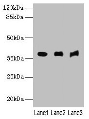 C5orf45 Antibody - Western blot All lanes: C5orf45 antibody at 4µg/ml Lane 1: Mouse kidney tissue Lane 2: Mouse heart tissue Lane 3: Hela whole cell lysate Secondary Goat polyclonal to rabbit IgG at 1/10000 dilution Predicted band size: 38, 30, 32 kDa Observed band size: 38 kDa