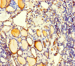 C5orf51 Antibody - Immunohistochemistry of paraffin-embedded human thyroid tissue using C5orf51 Antibody at dilution of 1:100
