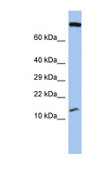 C5orf64 Antibody - FLJ37543 antibody Western blot of Fetal Stomach lysate. This image was taken for the unconjugated form of this product. Other forms have not been tested.