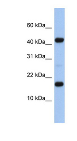 C5orf64 Antibody - FLJ37543 antibody Western blot of Fetal Heart lysate. This image was taken for the unconjugated form of this product. Other forms have not been tested.