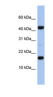 C5orf64 Antibody - FLJ37543 antibody Western blot of Fetal Heart lysate. This image was taken for the unconjugated form of this product. Other forms have not been tested.