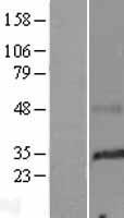 C6orf1 Protein - Western validation with an anti-DDK antibody * L: Control HEK293 lysate R: Over-expression lysate
