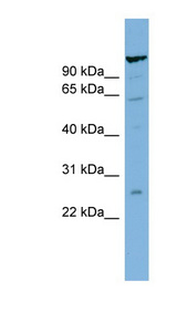 C6orf10 Antibody - C6orf10 antibody Western blot of ACHN lysate. This image was taken for the unconjugated form of this product. Other forms have not been tested.