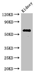 C6orf10 Antibody - Western Blot Positive WB detected in:Mouse kidney tissue All Lanes: C6orf10 antibody at 3.4ug/ml Secondary Goat polyclonal to rabbit IgG at 1/50000 dilution Predicted band size: 62 kDa Observed band size: 62 kDa
