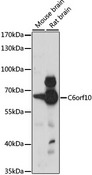 C6orf10 Antibody - Western blot analysis of extracts of various cell lines, using C6orf10 antibody at 1:1000 dilution. The secondary antibody used was an HRP Goat Anti-Rabbit IgG (H+L) at 1:10000 dilution. Lysates were loaded 25ug per lane and 3% nonfat dry milk in TBST was used for blocking. An ECL Kit was used for detection and the exposure time was 30s.