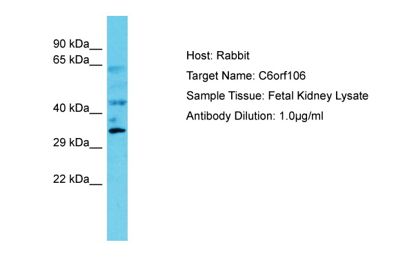 C6orf106 Antibody -  This image was taken for the unconjugated form of this product. Other forms have not been tested.