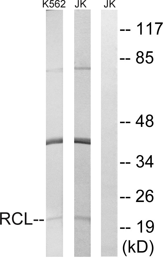 C6orf108 Antibody - Western blot analysis of lysates from Jurkat and K562 cells, using RCL Antibody. The lane on the right is blocked with the synthesized peptide.